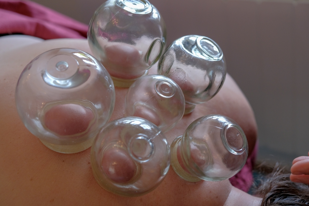 Seeking an alternative: Exploring Traditional Chinese Medicine and acupuncture in Exeter, Exploring Exeter 2019