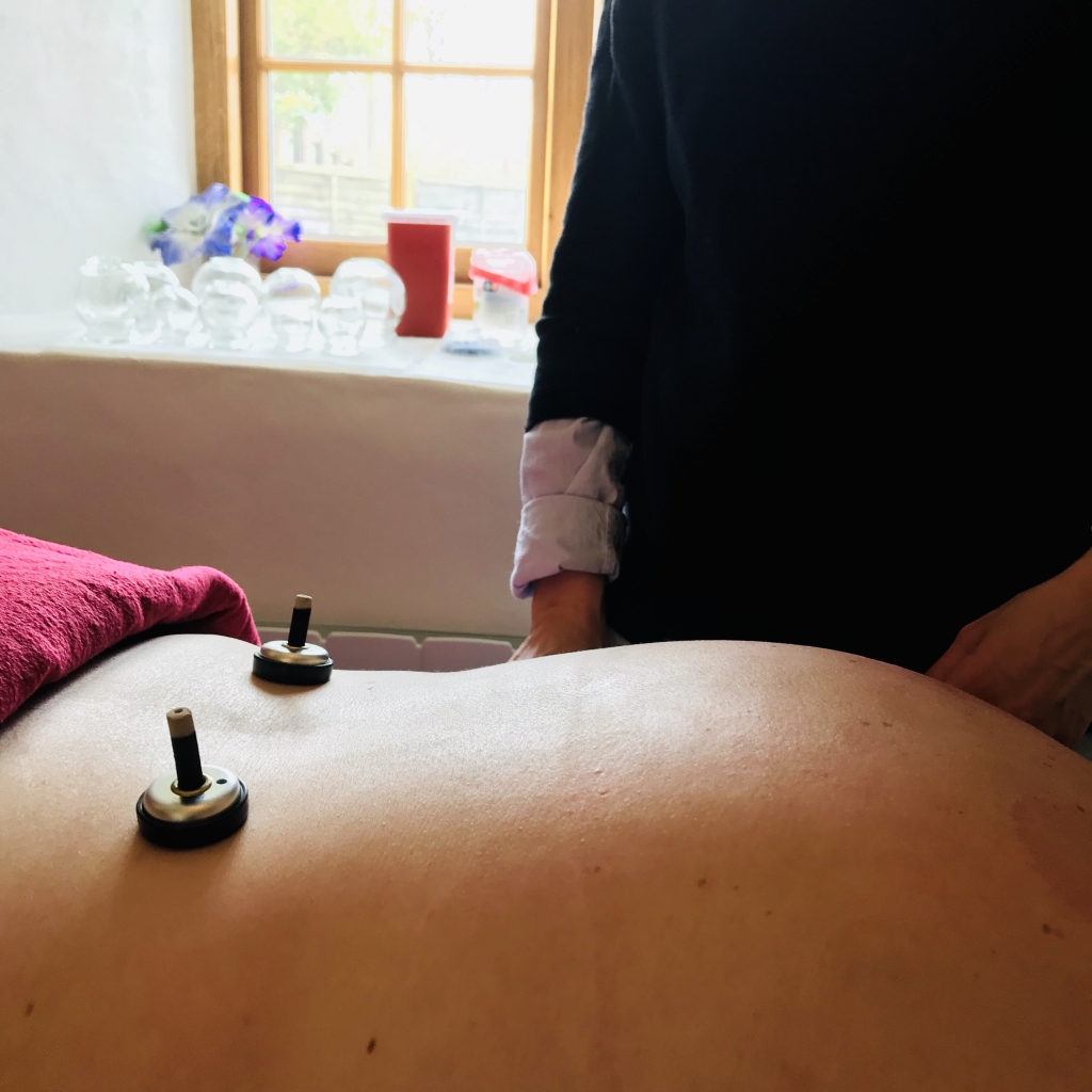 Seeking an alternative: Exploring Traditional Chinese Medicine and acupuncture in Exeter, Exploring Exeter 2019